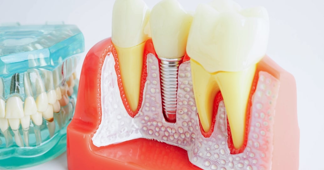 Treatment inner Parkview Dental