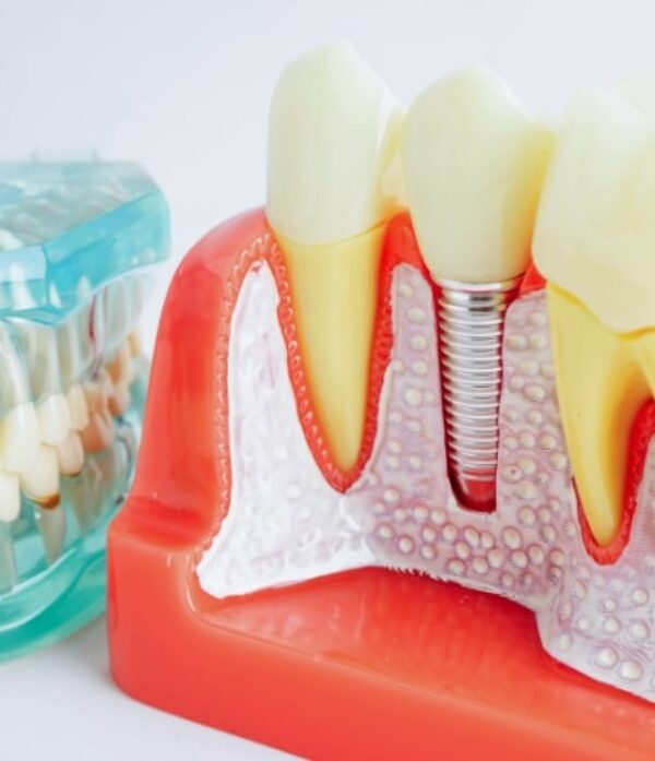 Treatment - Parkview Dental