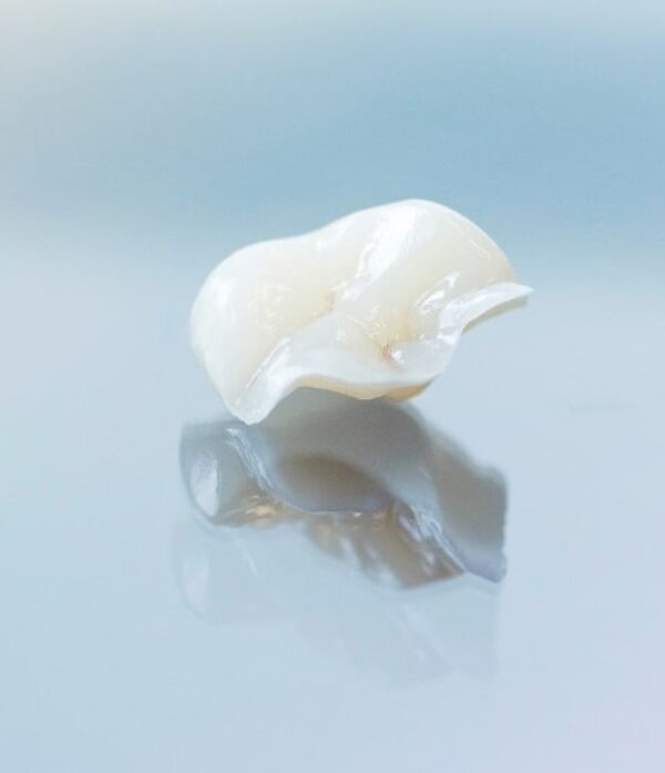 Treatment - Parkview Dental