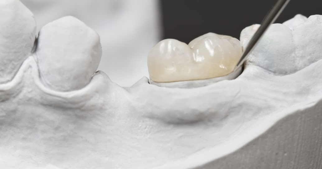 Treatment inner Parkview Dental